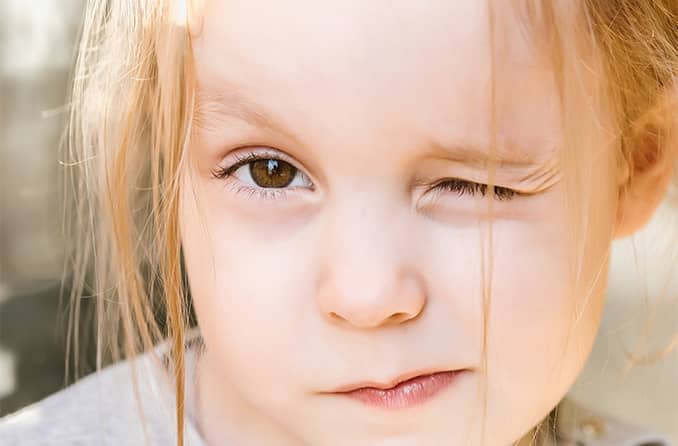 درمان آستیگمات چشم کودکان