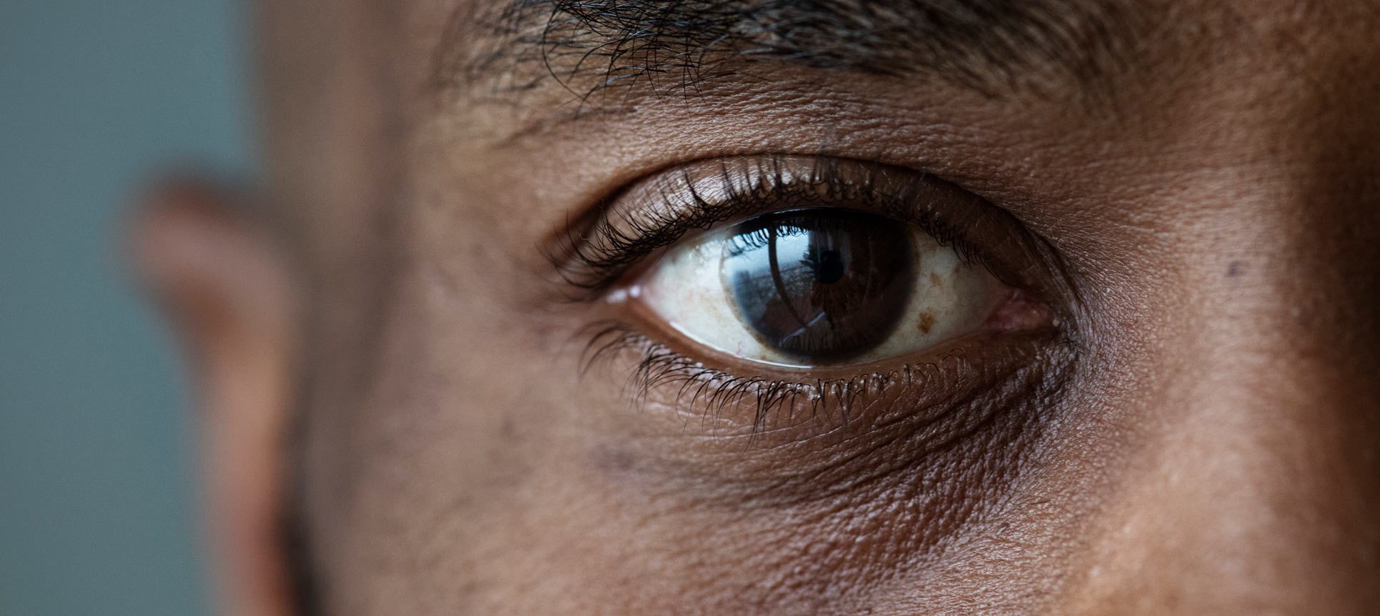 اختلال مگس پران چشمی چیست؟