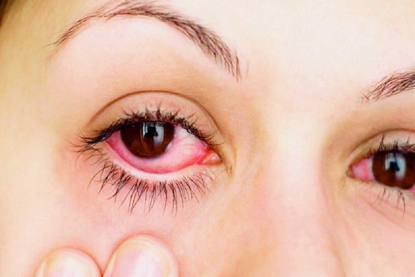 حساسیت چشم را هنگام استفاده از لنز